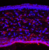 IF of P10 mouse cornea labeled with DSHB antibody CPTC-EPHB4-1 aginst EPH receptor B4 (red). Image credit Lachke Laboratory, University of Delaware 